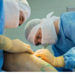 VASCULAR SURGERY